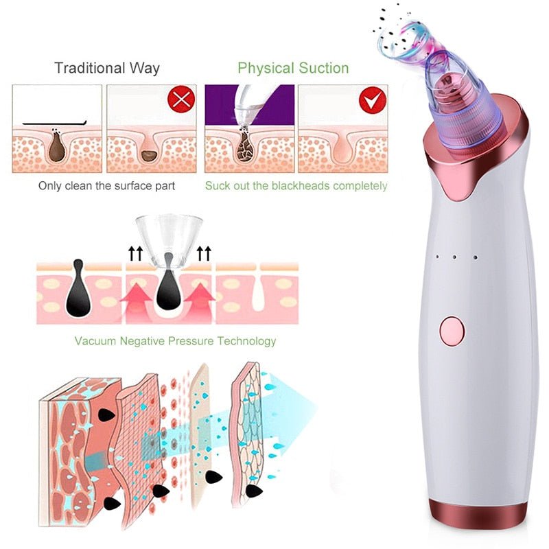 Electric Acne Remover | Blackhead Vacuum Extractor Tool | Black Spots Pore Cleaner image 10