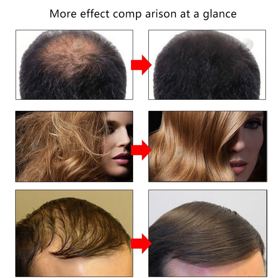 Hair Growth Oil Restoration Growing Serum image 3