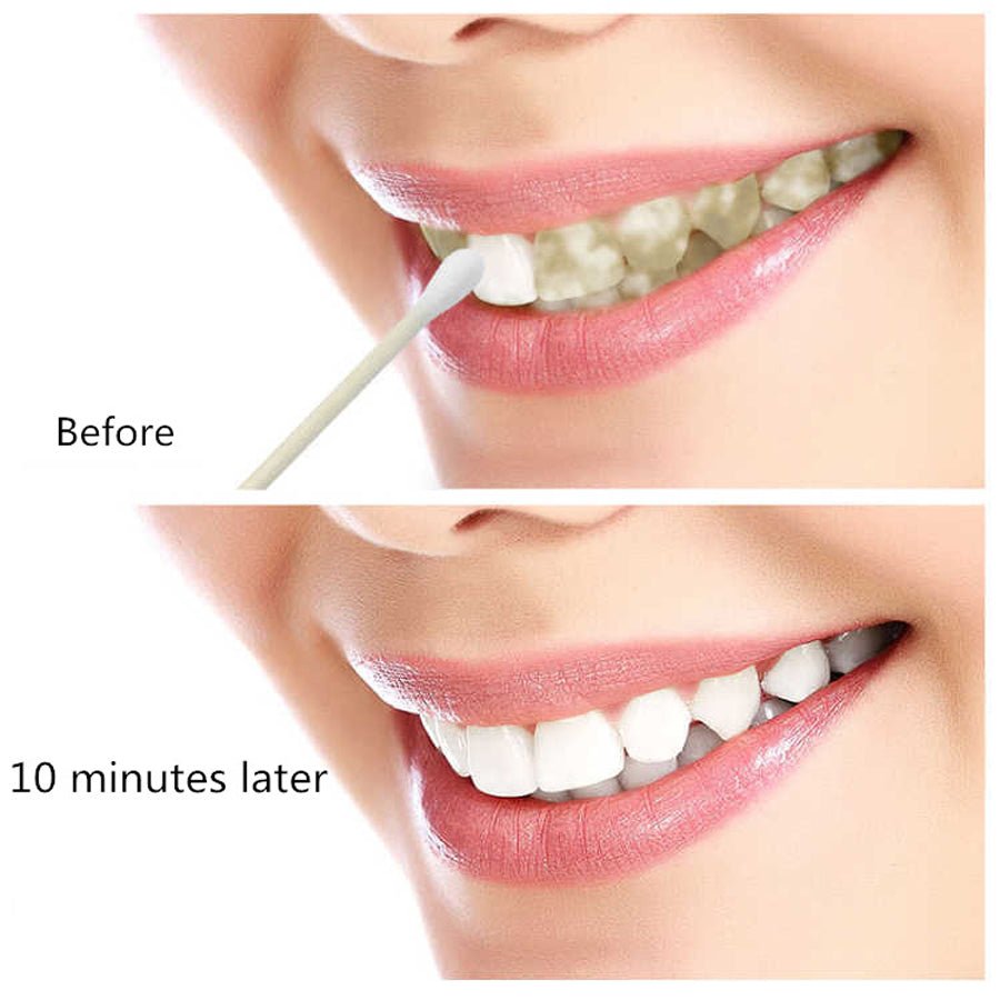 EFERO Teeth Whitening Essence Powder For Clean Oral Hygiene Whiten Teeth Remove Plaque Stains Fresh Breath Oral Hygiene Dental Tools image 6