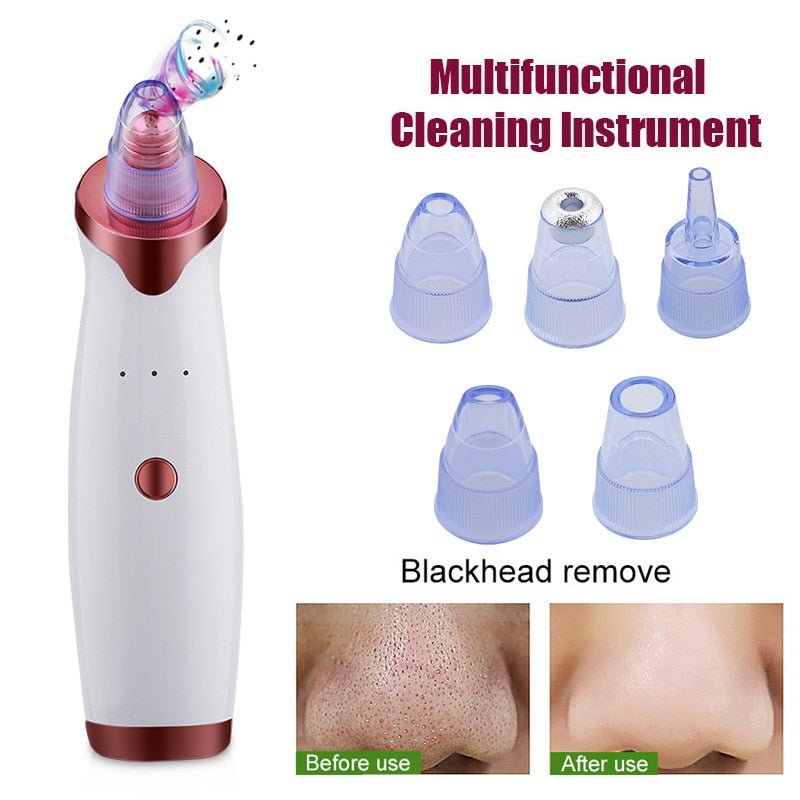 Electric Acne Remover | Blackhead Vacuum Extractor Tool | Black Spots Pore Cleaner image 28
