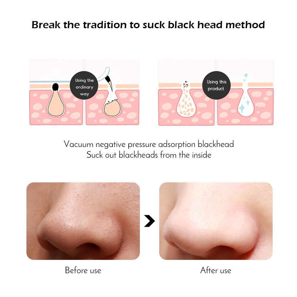 Face Acne Black Dot Pimple Blackhead Remover | Electric Microcrystalline Blackhead Vacuum Skin Care Machine image 5