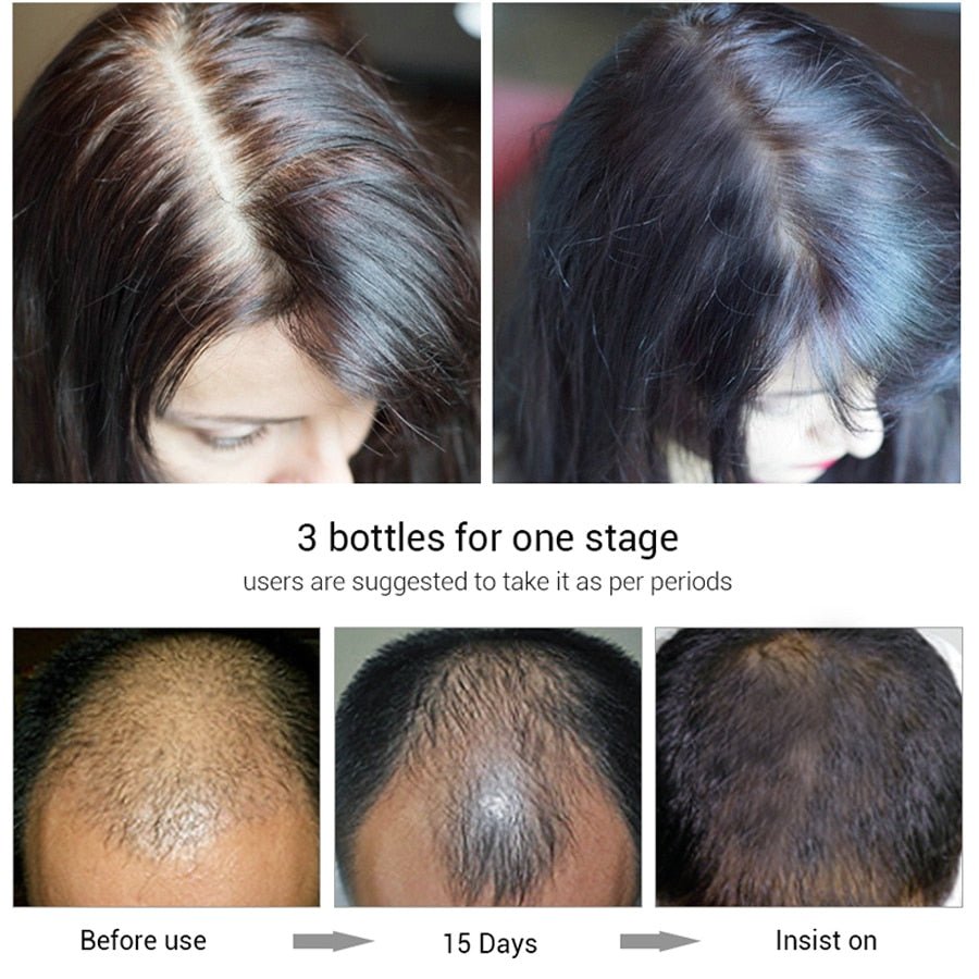 Hair Growth Oil Restoration Growing Serum image 0