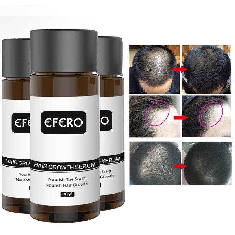Hair Growth Oil Restoration Growing Serum image 10