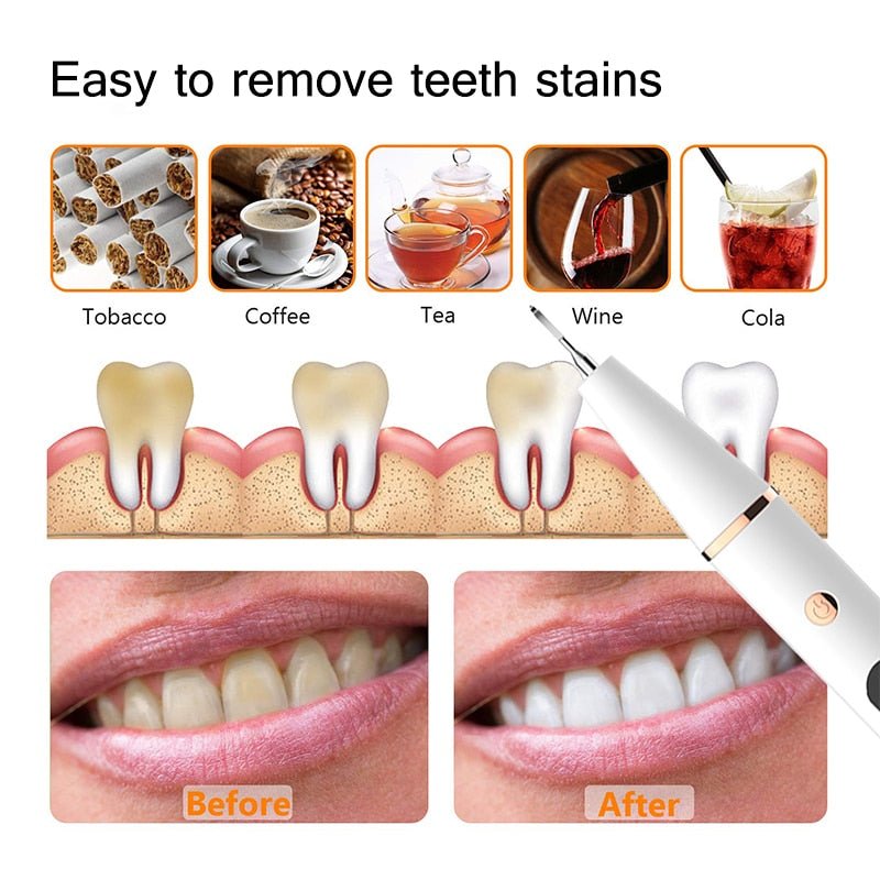 Portable Electric Sonic Dental Calculus Scaler Oral Teeth Tartar Remover Plaque Stains Teeth Whitening with LED image 11