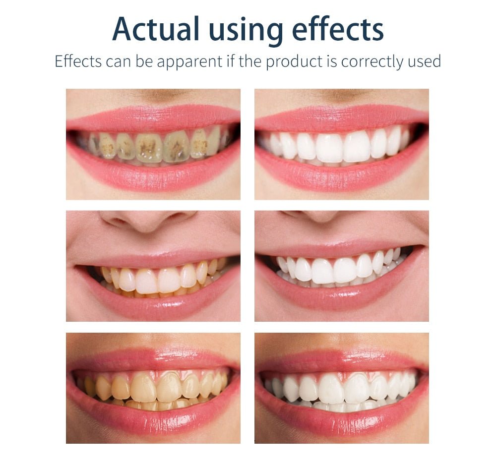 BAIMISS Fresh Shining Tooth-Cleaning Mousse Teeth Whitening Toothpaste image 11