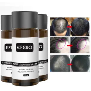 Hair Growth Oil Restoration Growing Serum image 0