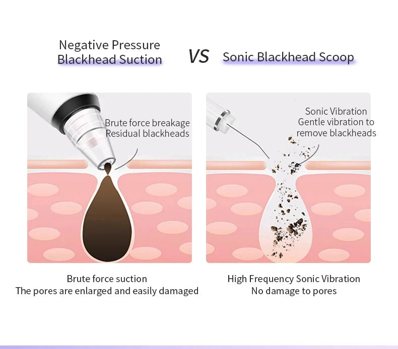 Ultrasonic Skin Scrubber Face Spatula Pore Cleaner Blackhead Remover Facial Lifting Ion Deep Cleansing Beauty Device For Home Us
