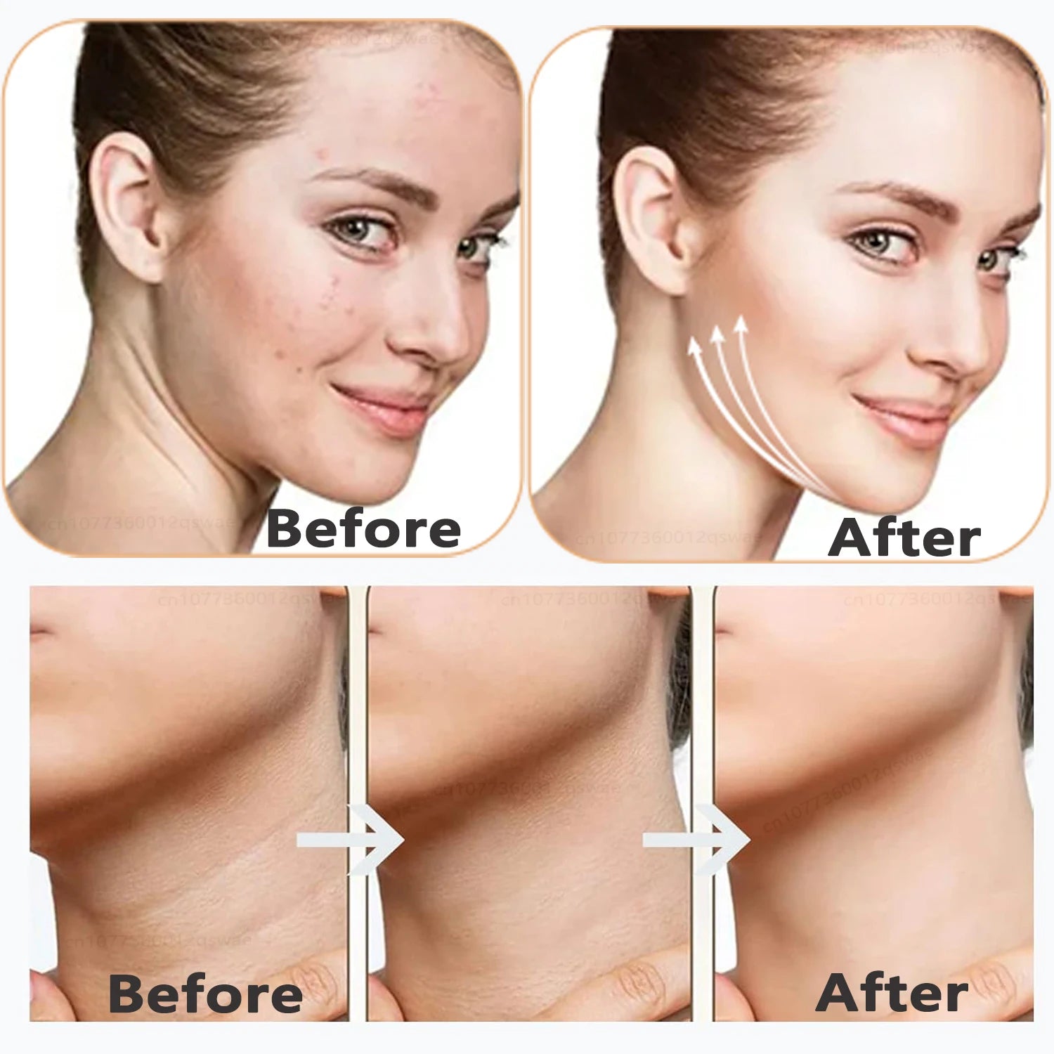 Face Lift EMS Microcurrent Neck Lift Device Slim Massager Facial Lifting Tightening Face Wrinkle Remover Facial Massager