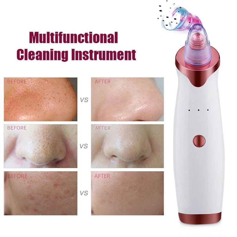 Electric Acne Remover | Blackhead Vacuum Extractor Tool | Black Spots Pore Cleaner image 14