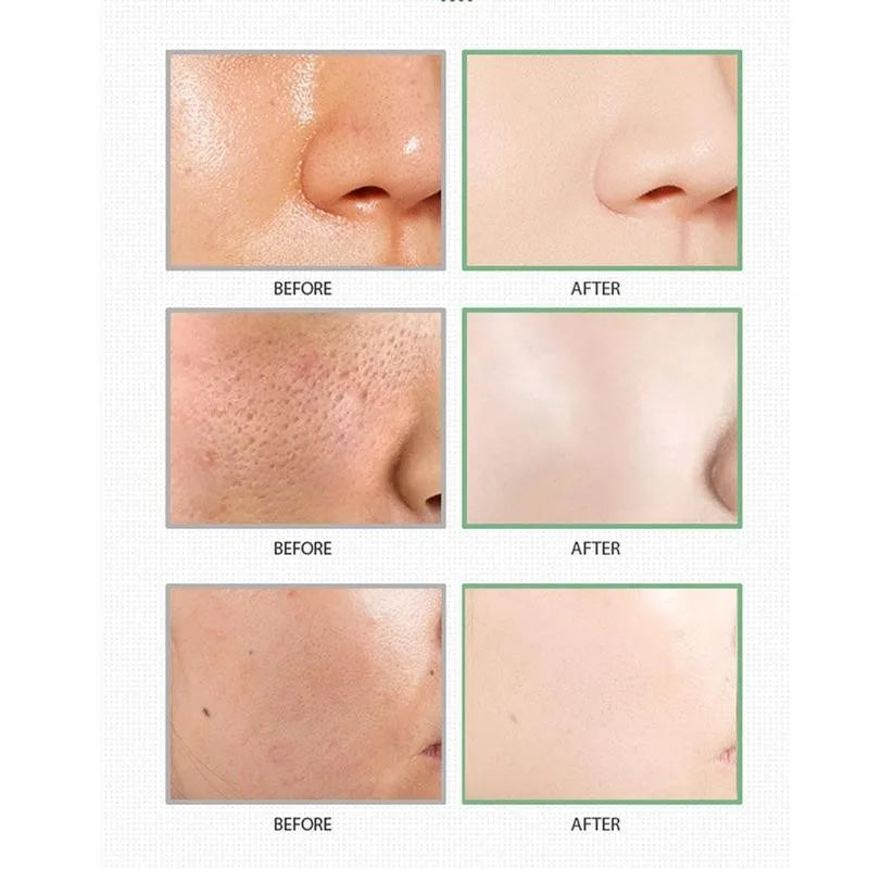 40g Cleansing Green Tea Bar Mask | Cleansing Mud Bar Mask Oil Control | Anti Acne Eggplant Skin Care Whitening Shrinkage Pore image 23