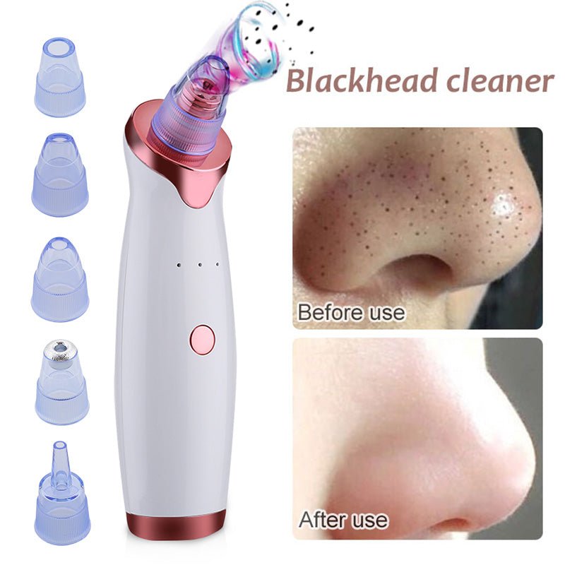 Electric Acne Remover | Blackhead Vacuum Extractor Tool | Black Spots Pore Cleaner image 11