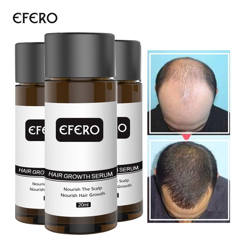 Hair Growth Oil Restoration Growing Serum image 4