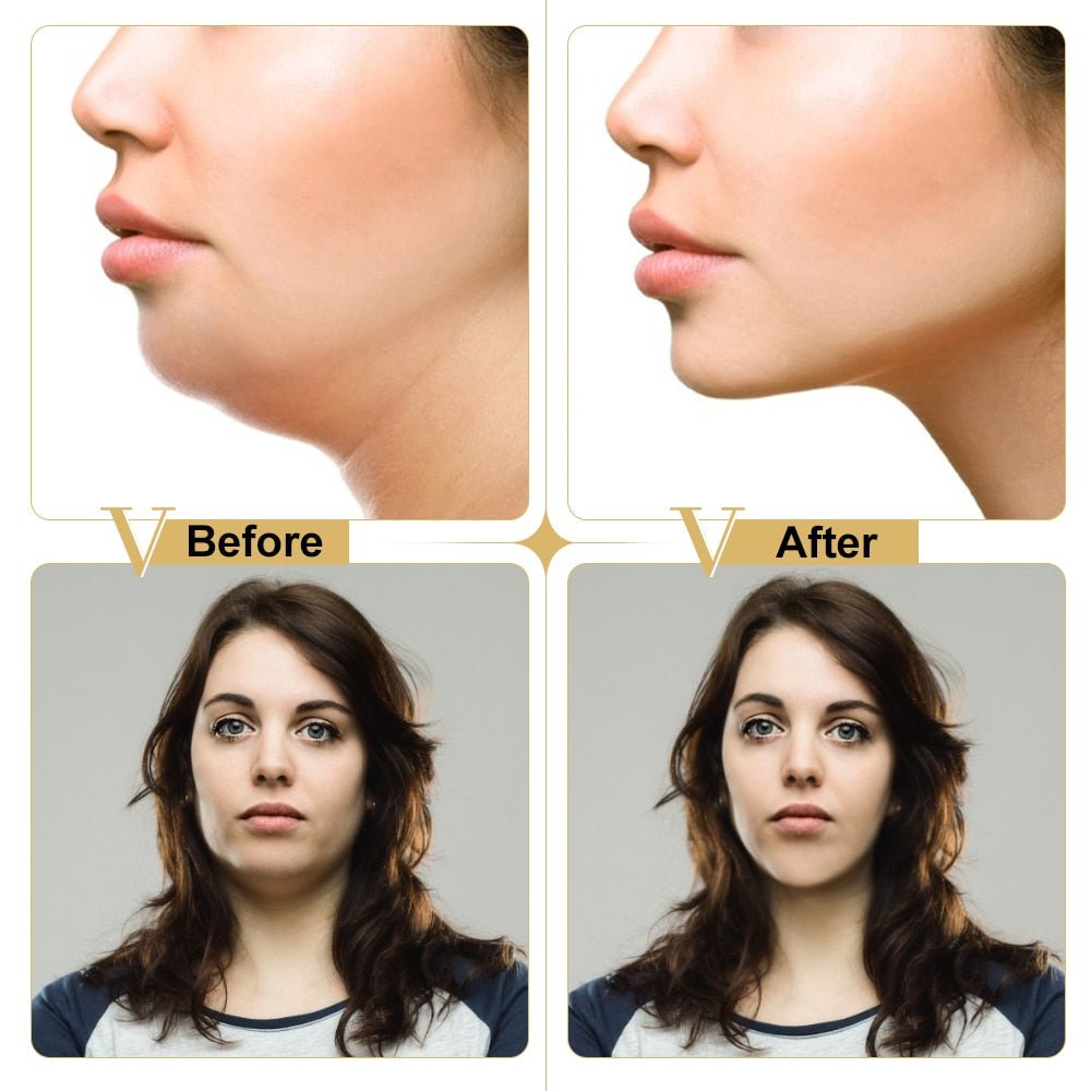 Delicate Thin Face Slimming Bandage | Face Lifting Miracle V Shaped Slimming Mask and Facial Line Remover image 0